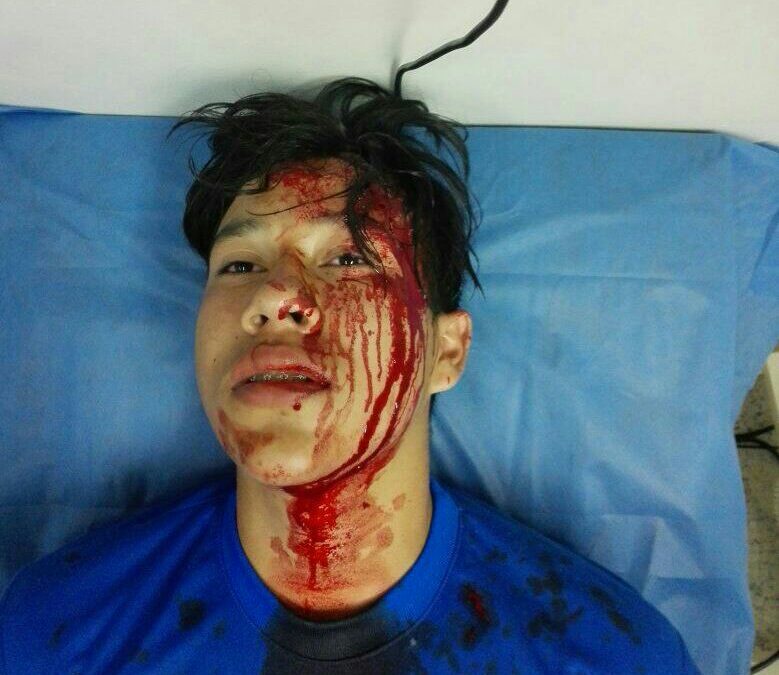 Más de 50 estudiantes heridos por represión militar y policial en Venezuela