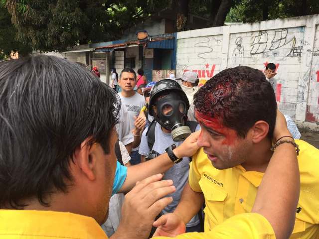 El diputado José Manuel Olivares fue herido en la cabeza por bomba lacrimógena