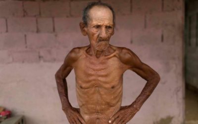 ONU retomó programa para enfrentar el hambre en Venezuela