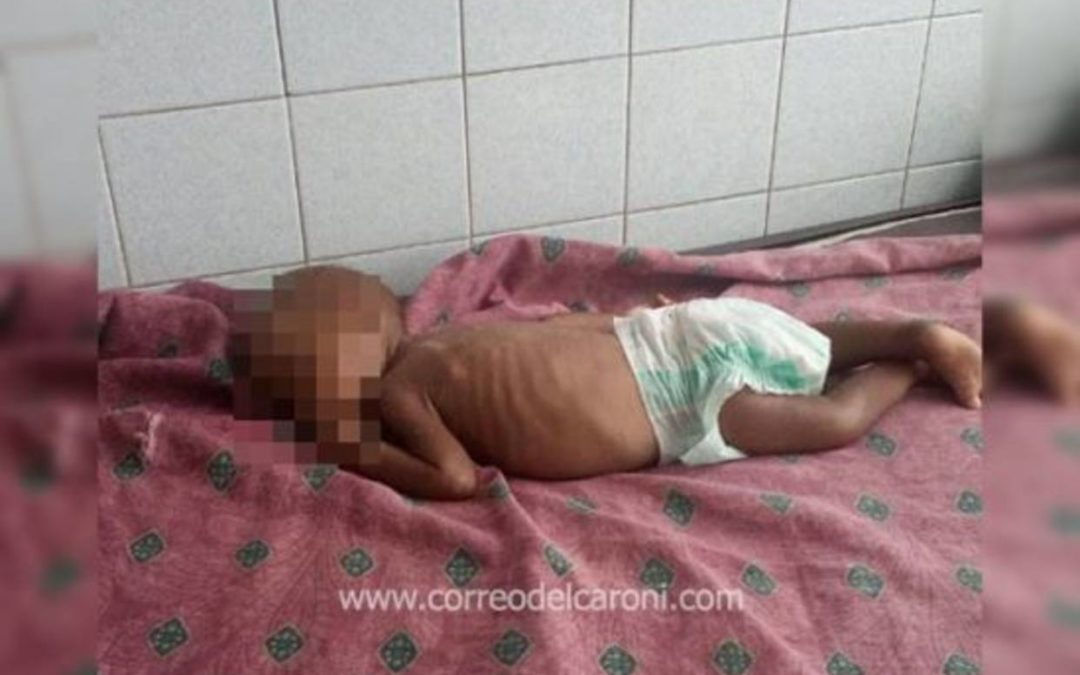 Denuncian que 41 niños han muerto de hambre en hospital de San Félix